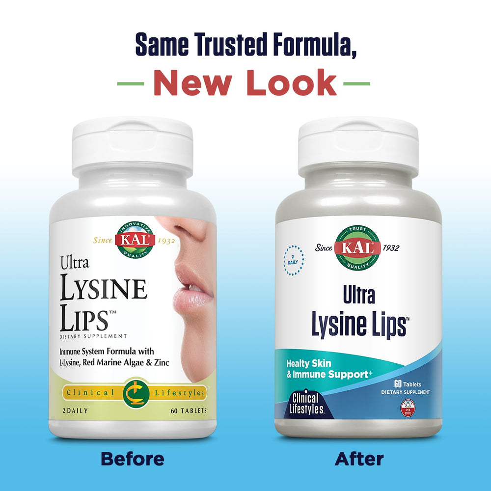 Close-up of Kal Ultra Lysine Lips Tablets bottle and tablets