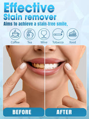 Whitening kit being used at home