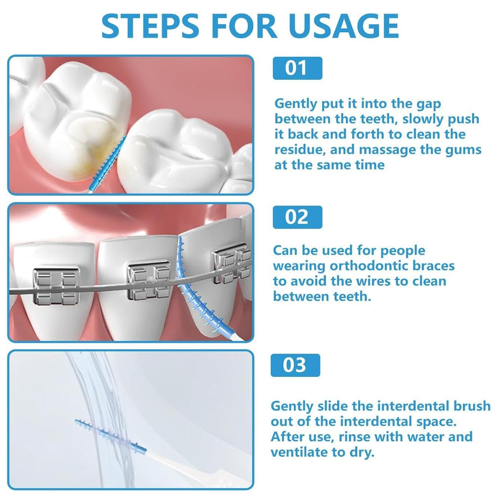 Interdental brush reaching between teeth and braces