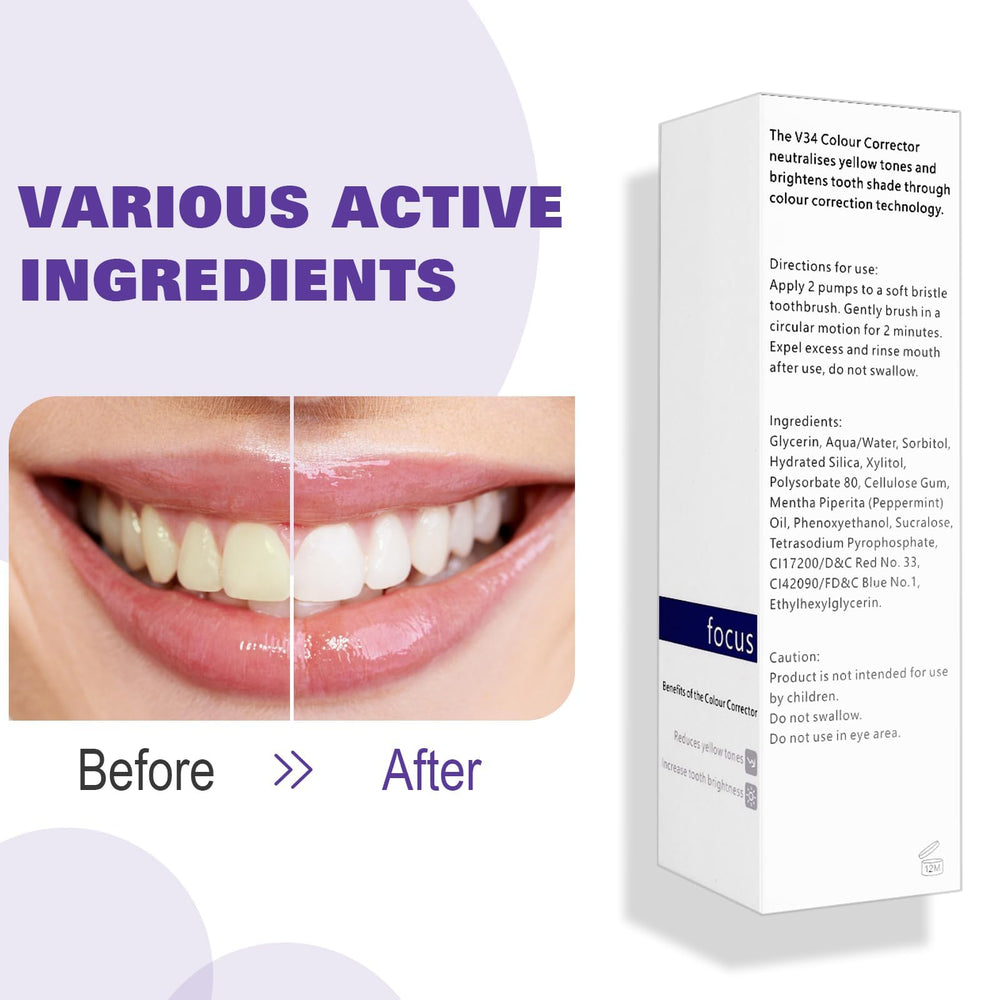 Note: not a full whitening treatment