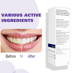 Note: not a full whitening treatment