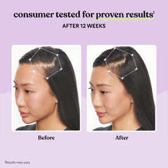 Clinical study concept for Cynatine HNS keratin complex