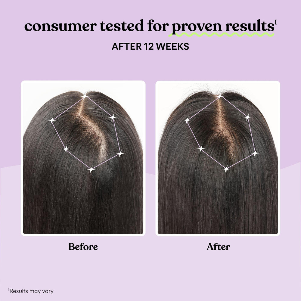 Illustration of thicker, fuller hair showing growth and reduced shedding