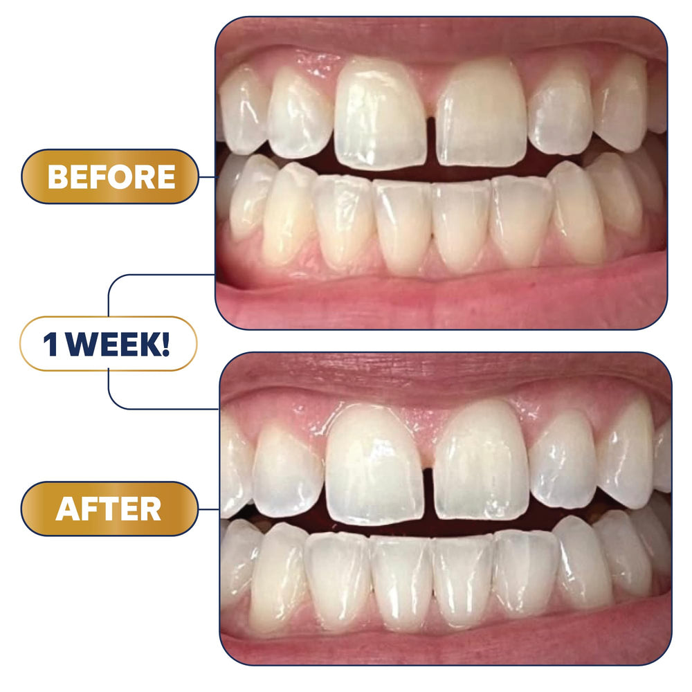 Clinically proven whitening results image