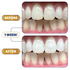 Illustration of long-lasting whitening results