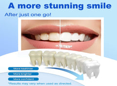 Whitening gel removes coffee stains from teeth