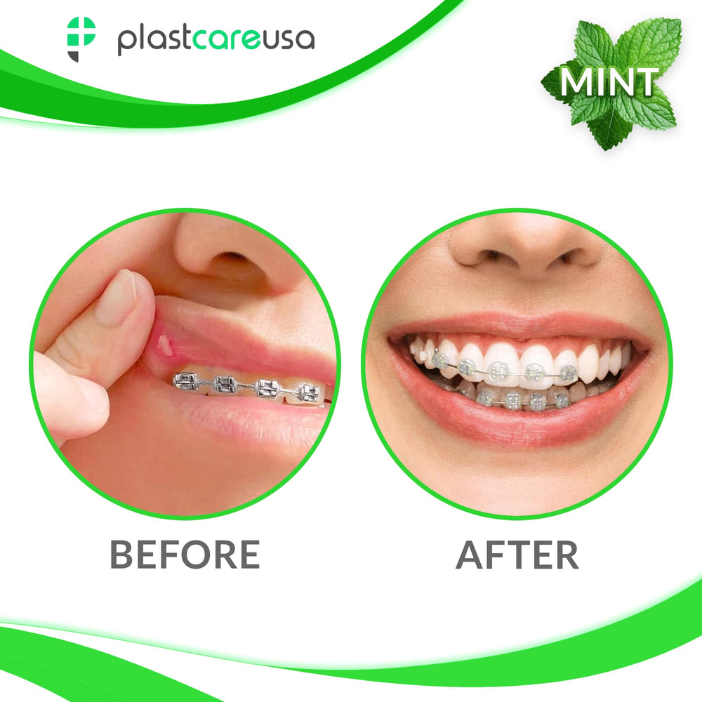 Portable travel pack of mint orthodontic wax