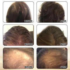 Biotin-rich Miracle Elixir supplement bottle close-up
