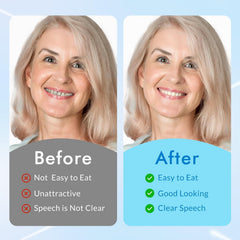 Easy cleaning moldable teeth