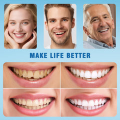 Close-up view of denture color matching natural teeth