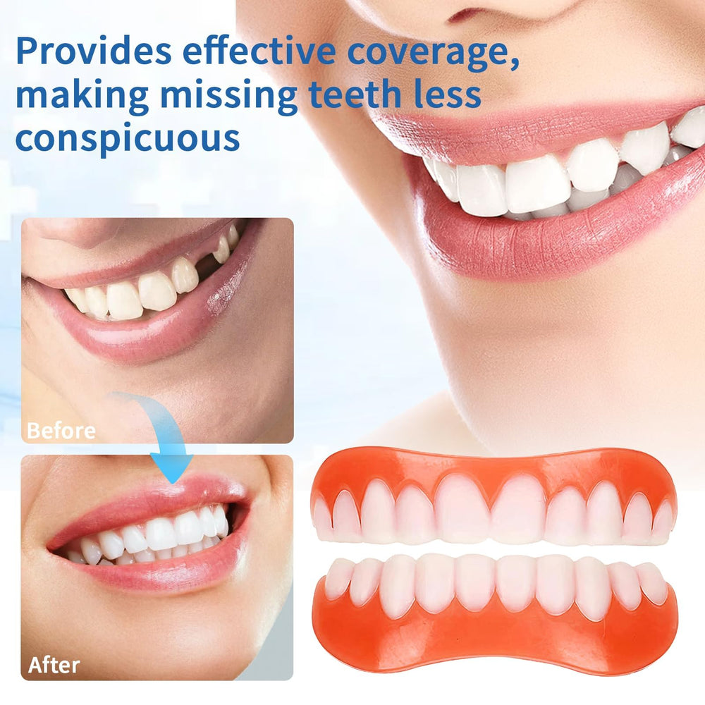 Fast molding process to fit gums without tools