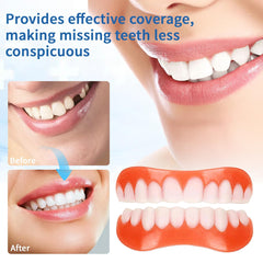 Fast molding process to fit gums without tools