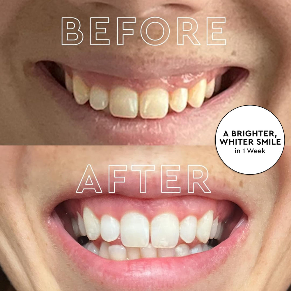 MOON LED whitening light device