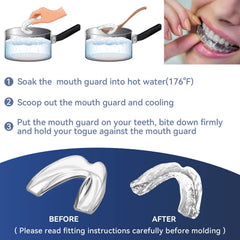 Storage case for mouth guards