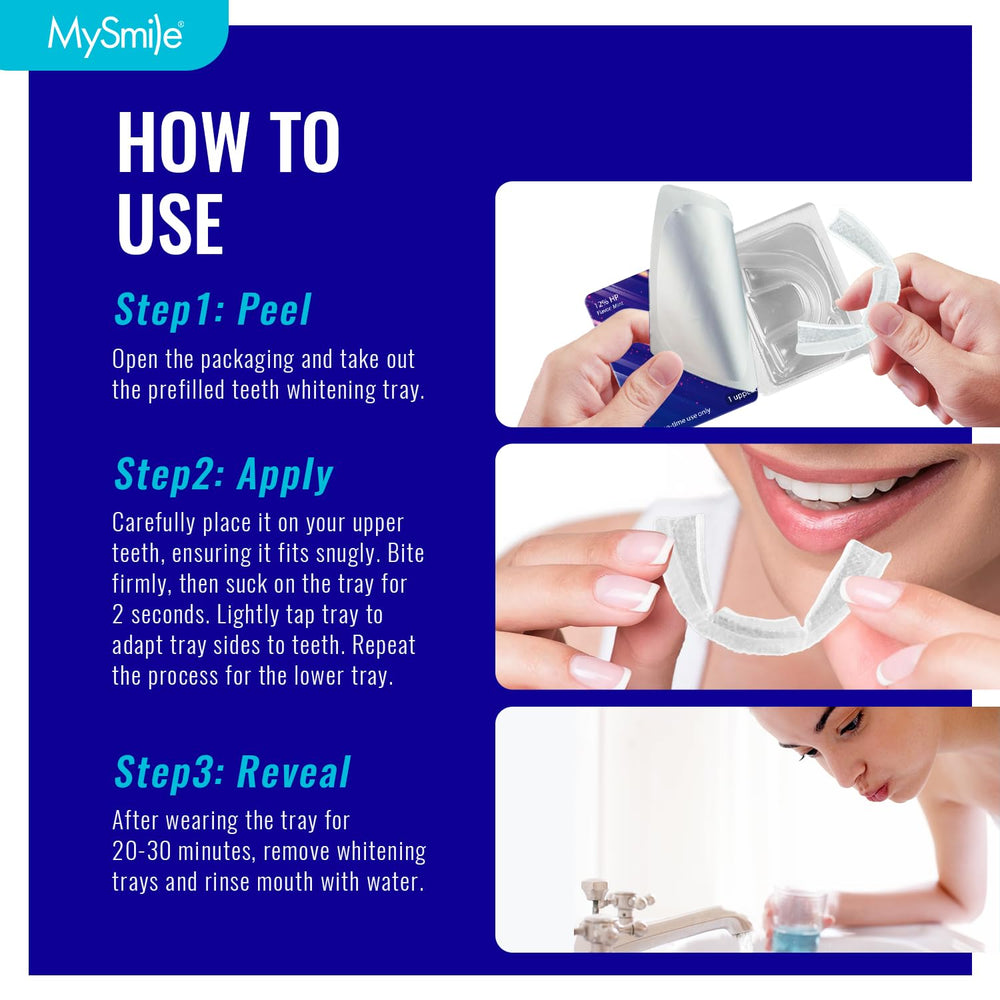 No LED light required for at-home whitening