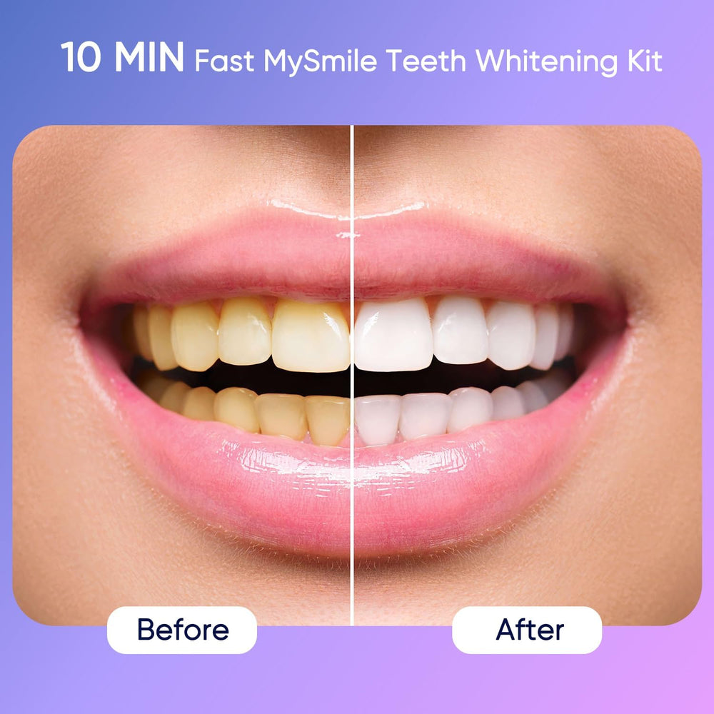 LED light unit and whitening gel close-up