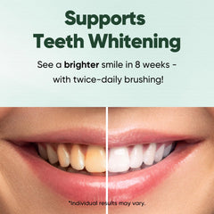 Kit includes whitening strips and fluoride-free toothpaste 4.2oz