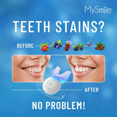 User whitening results showing brighter teeth