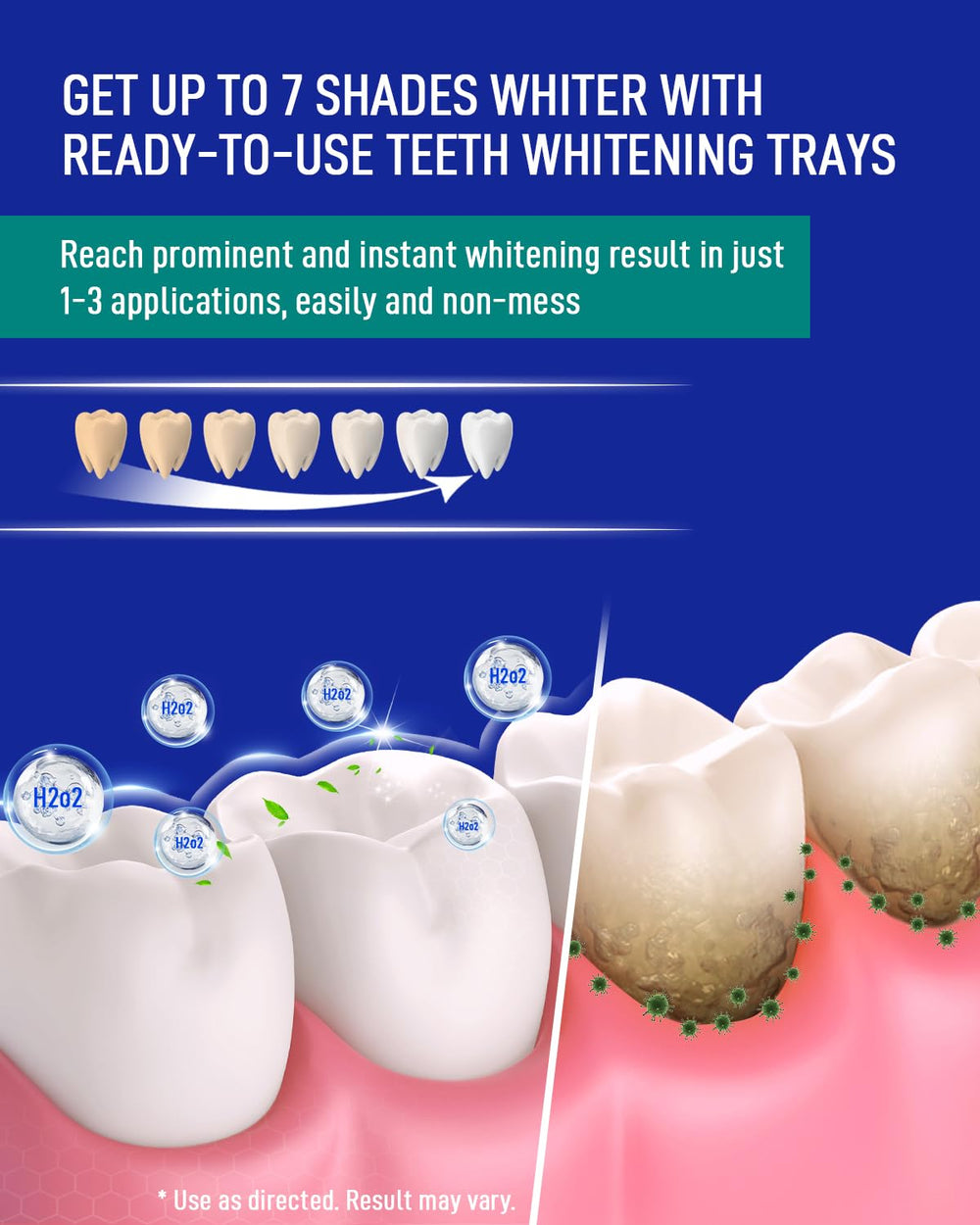 Gentle whitening solution designed for sensitive teeth