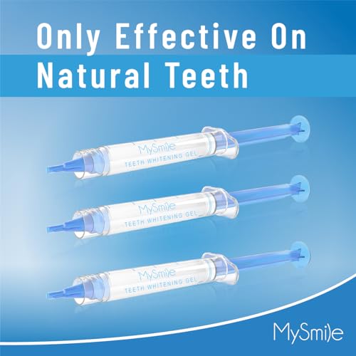 After photo showing whiter teeth from MySmile kit
