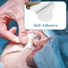 Nasal splints placed on nose after activation
