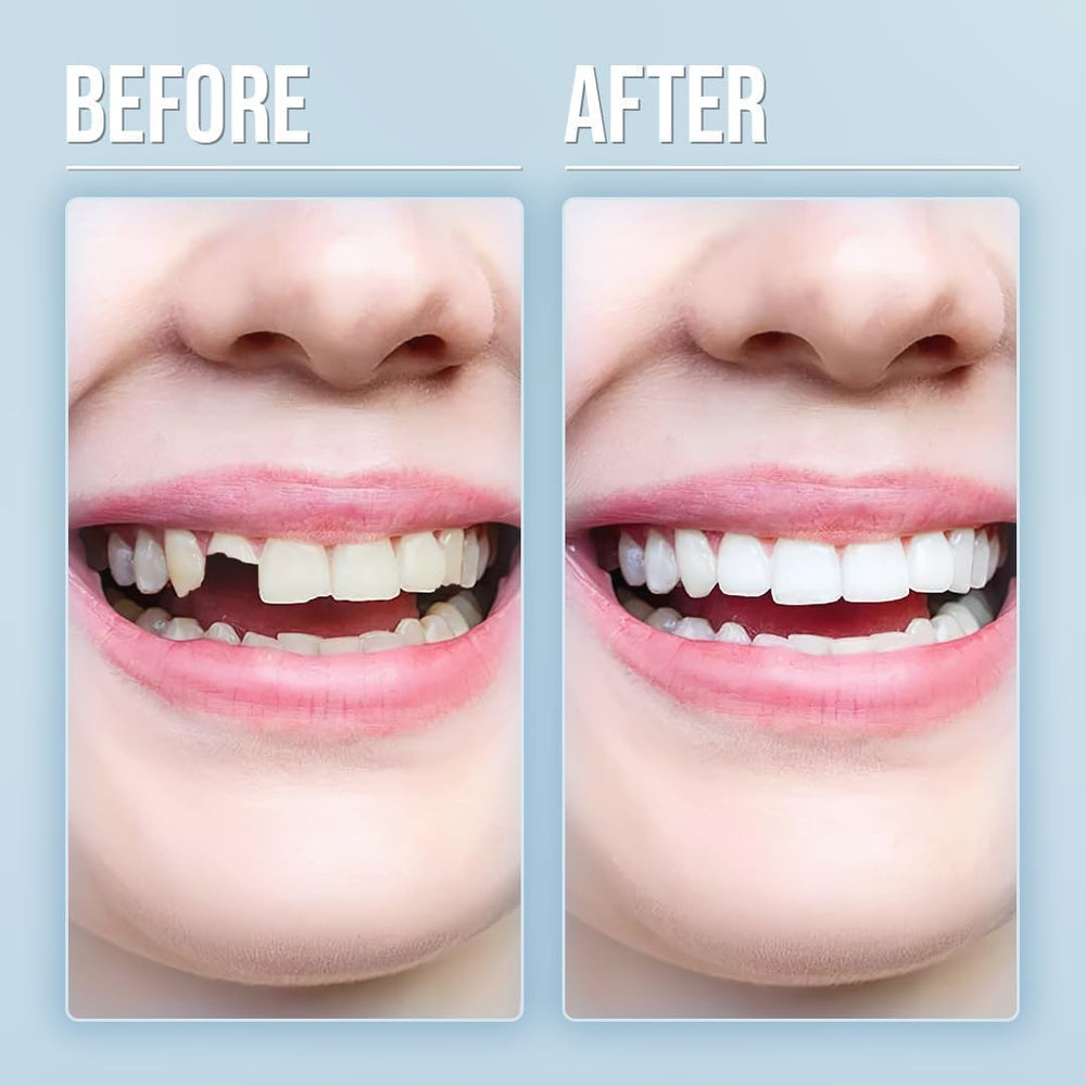 Model wearing natural-looking dentures