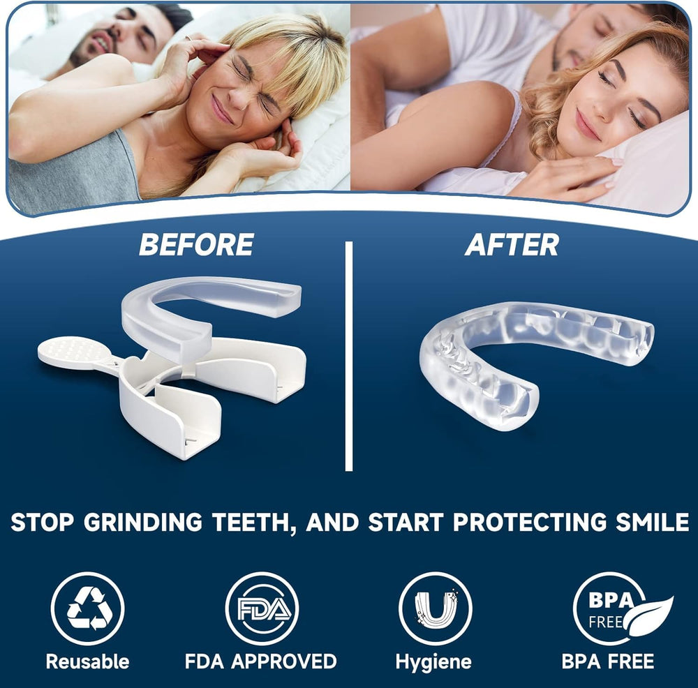 Close-up of ergonomic night guard design for bruxism prevention