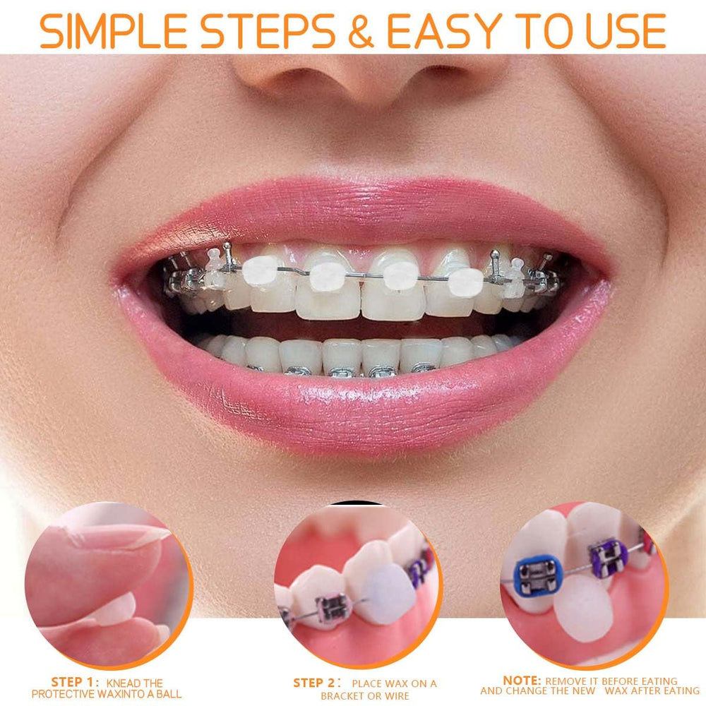 Close-up of clear blend braces wax blending with teeth