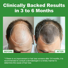 Sugar-free orange-flavored vegan gummies