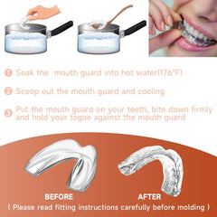 Mouth guard protecting teeth from grinding at night