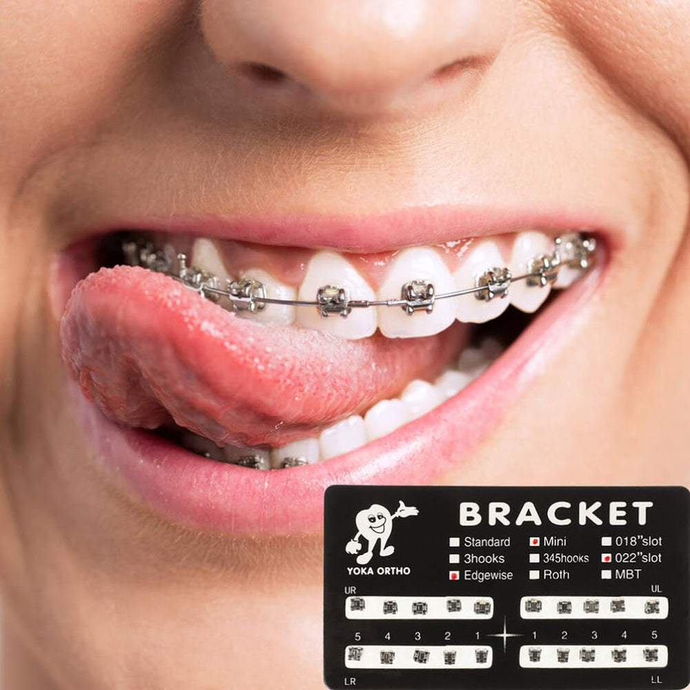 Detailed view of bracket edges and hooks