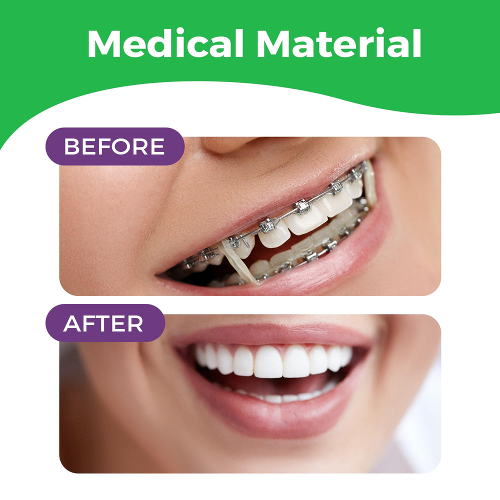 Close-up of heavy-force orthodontic elastics for braces