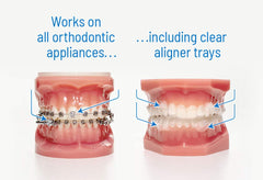 Moisture-activated OrthoDots adhering to braces