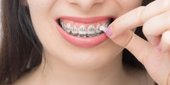 Clear, discreet orthodontic wax blending with teeth