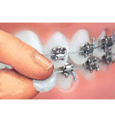 Orthowax suitable for partial dentures with wire clasps