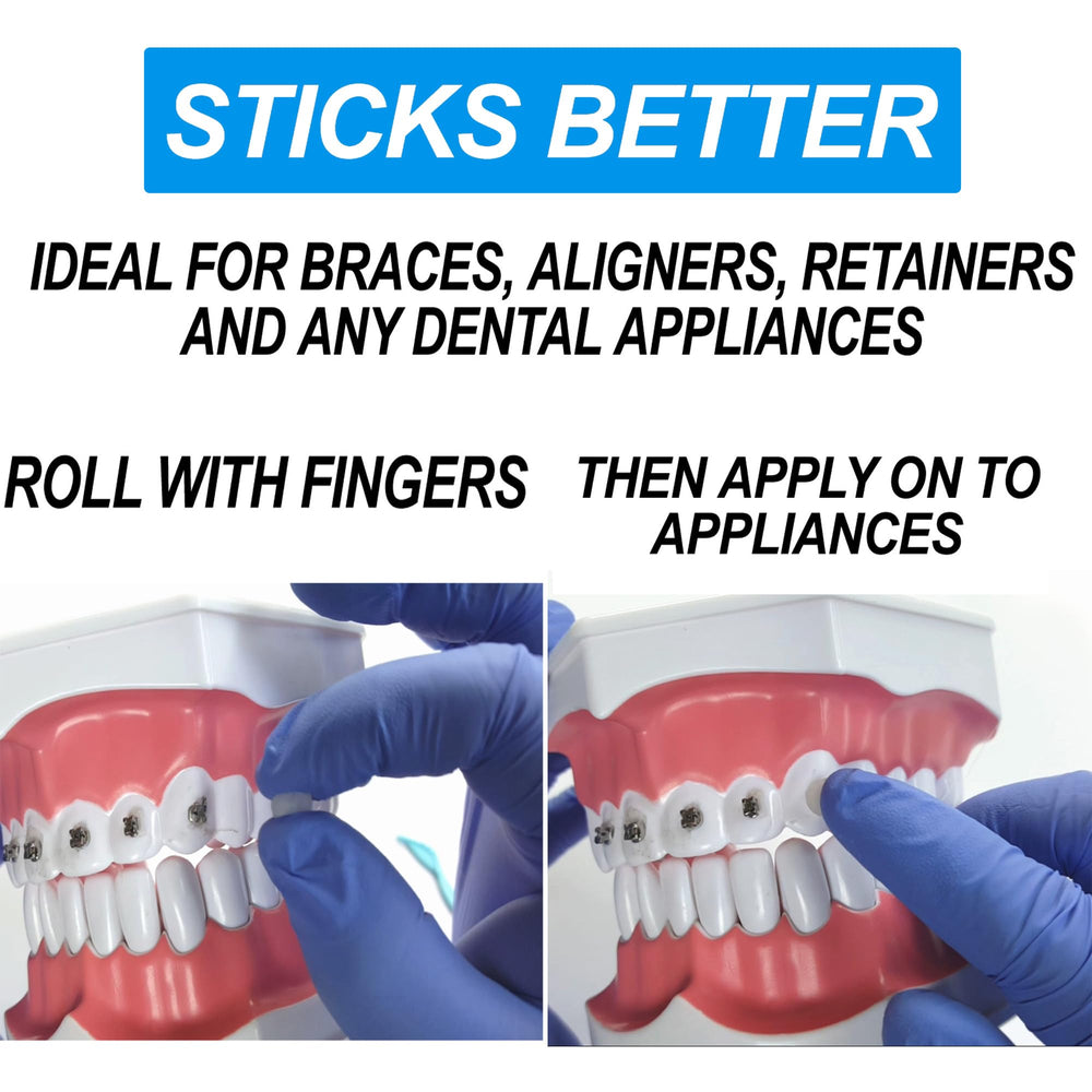 Relief from irritation for braces including ligatures, wires, springs and brackets