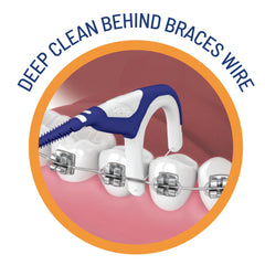 Diagram showing how to use OrVance Braces Flosser for braces cleaning