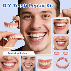 Complete DIY denture kit for temporary emergencies