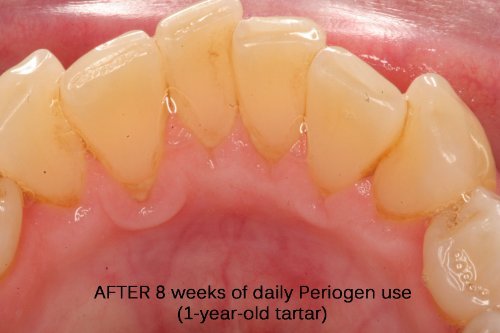 Periogen 3-PK usage and directions image