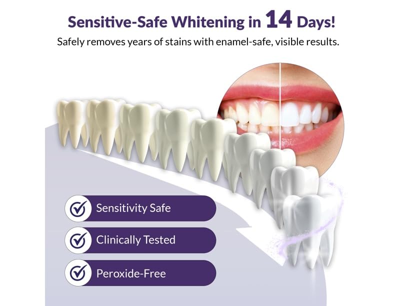 Bright, healthy-looking smile after whitening