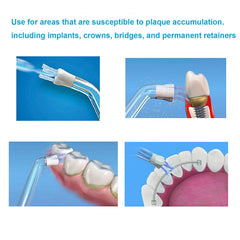 Tip for cleaning around bridges and permanent retainers with a water flosser