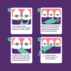 Flossers removing food particles around braces brackets