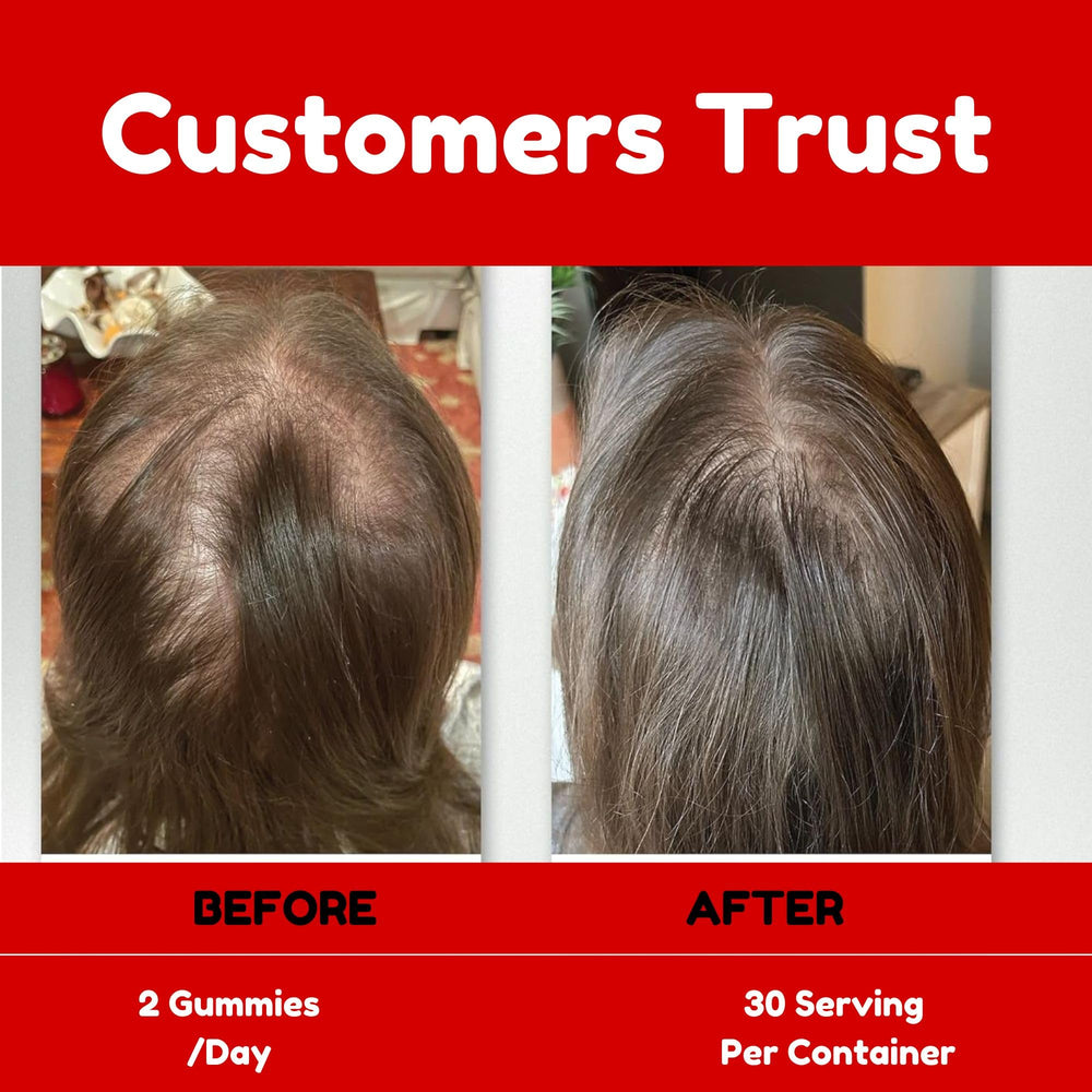 Graphic depicting prostate and urinary tract support benefits