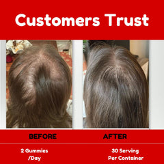 Graphic depicting prostate and urinary tract support benefits