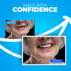 Premium materials used in the denture kit