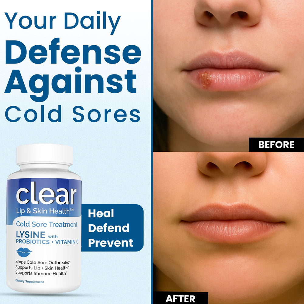 Image showing prevention-focused cold sore lip treatment