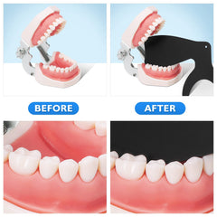 All six models of the Protector 6 Pcs Dental Contraster arranged for display