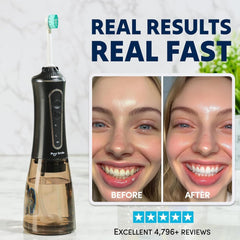 Durable and leakproof 300ML water tank for PuurSmile water flosser