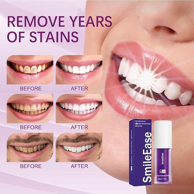Toothpaste removing cigarette smoke stains