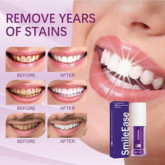 Toothpaste removing cigarette smoke stains
